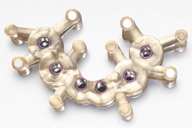 Guide chirurgical dentaire imprimé en 3D